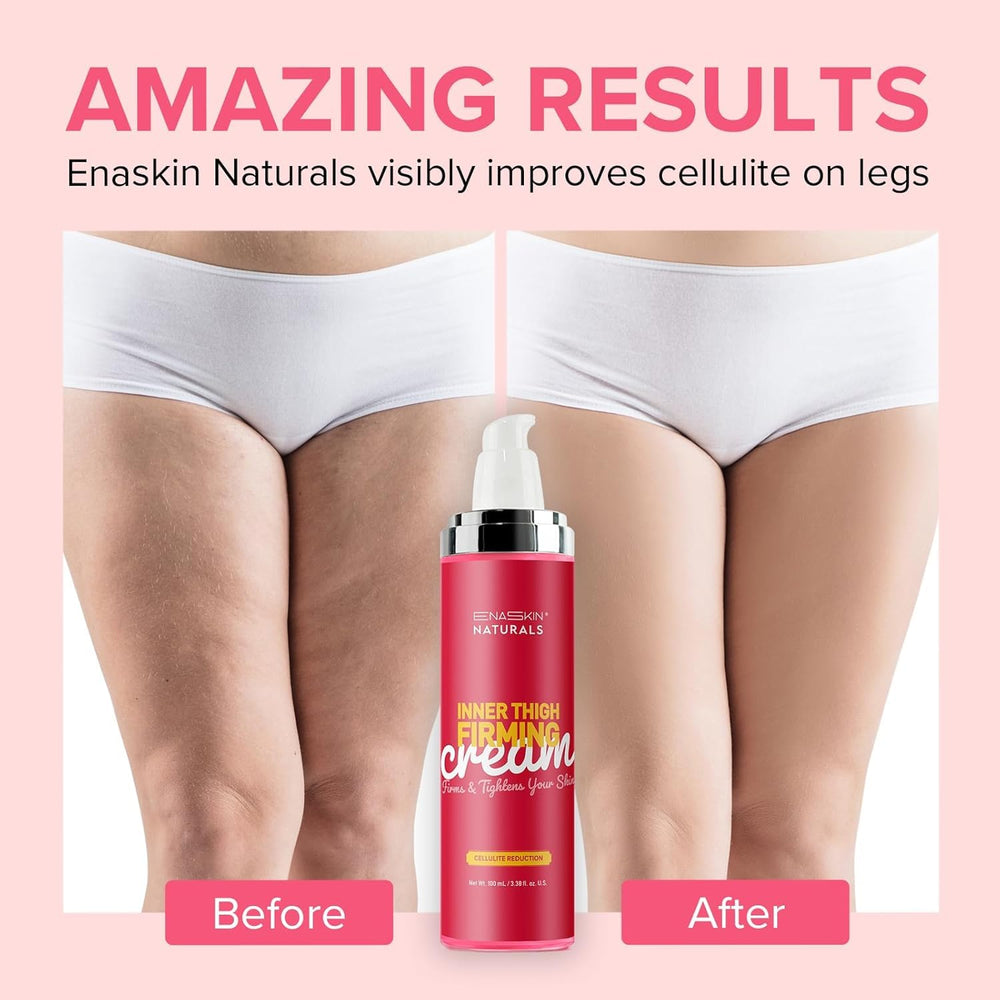 Enaskin Naturals anti-cellulite cream close-up, rich texture for smoothing skin.
