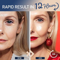 Enaskin Naturals cream texture closeup reveals rich, hydrating formula ready for application