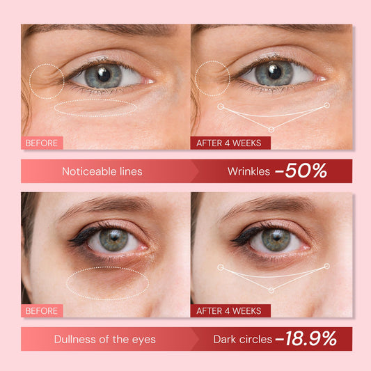 Enaskin Naturals Retinol Eye Cream tip applicator for precise under-eye application