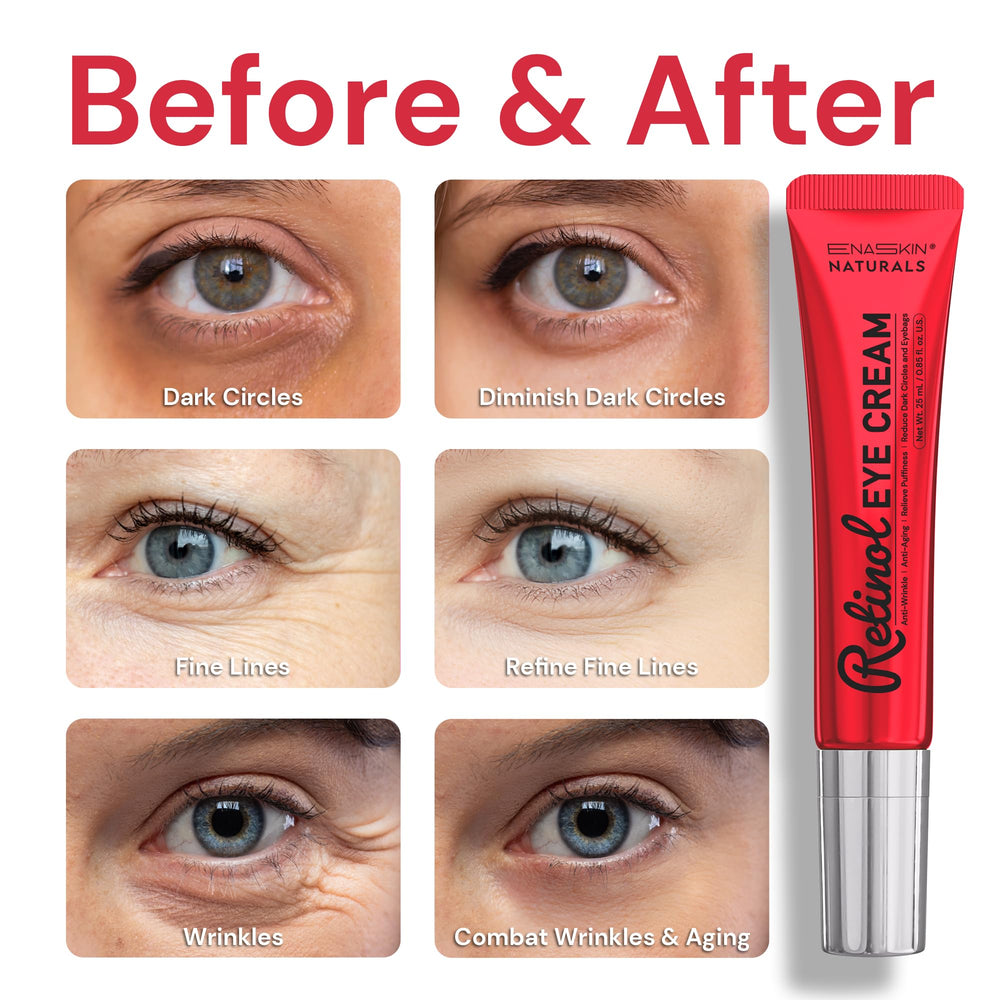 Under-eye area being treated with Enaskin Naturals eye cream for a refreshed look.