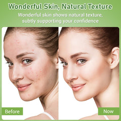 Eofot pore clarity closeup emphasizes smoother-looking complexion