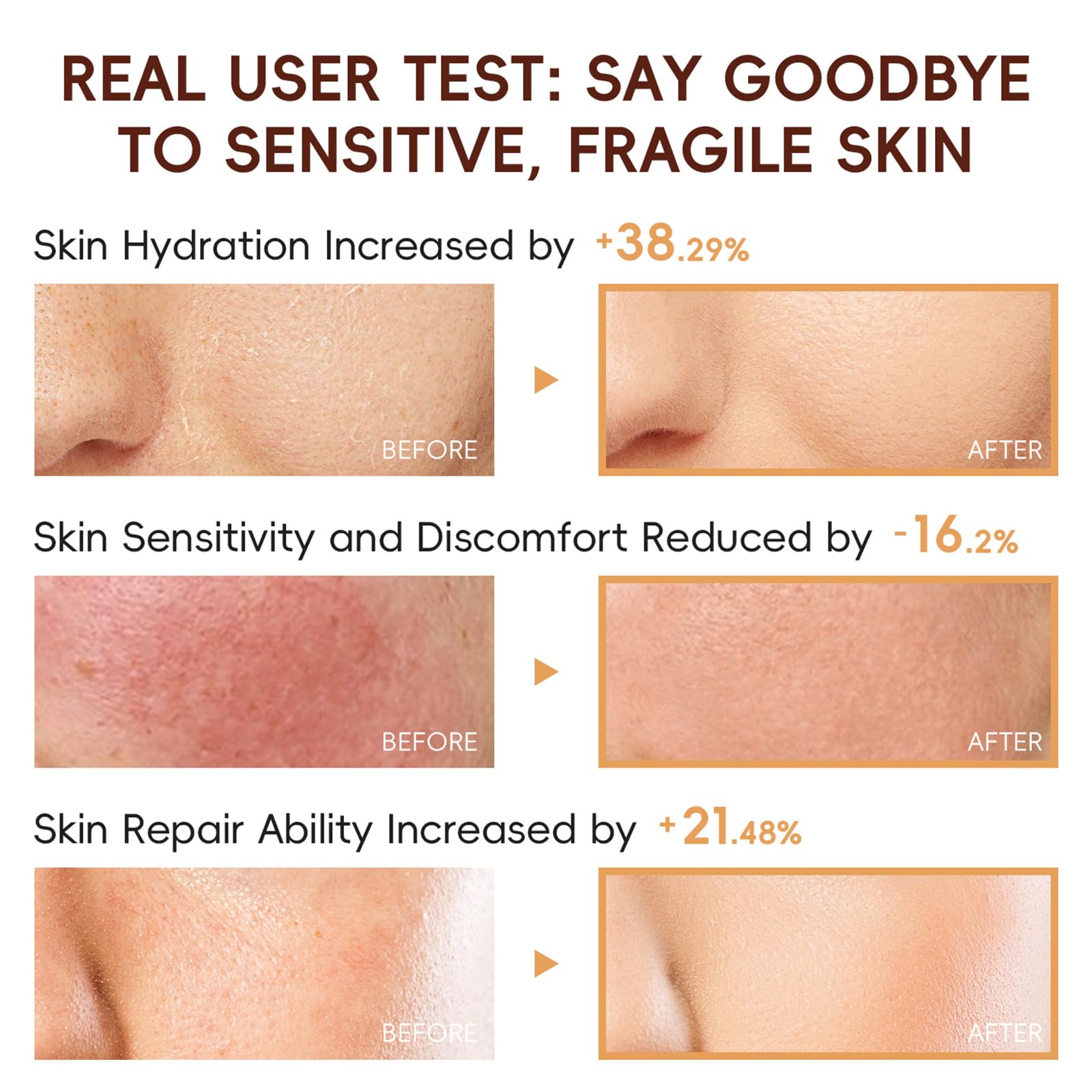 EONFAVE rice skincare set face-cream locks in moisture and softness