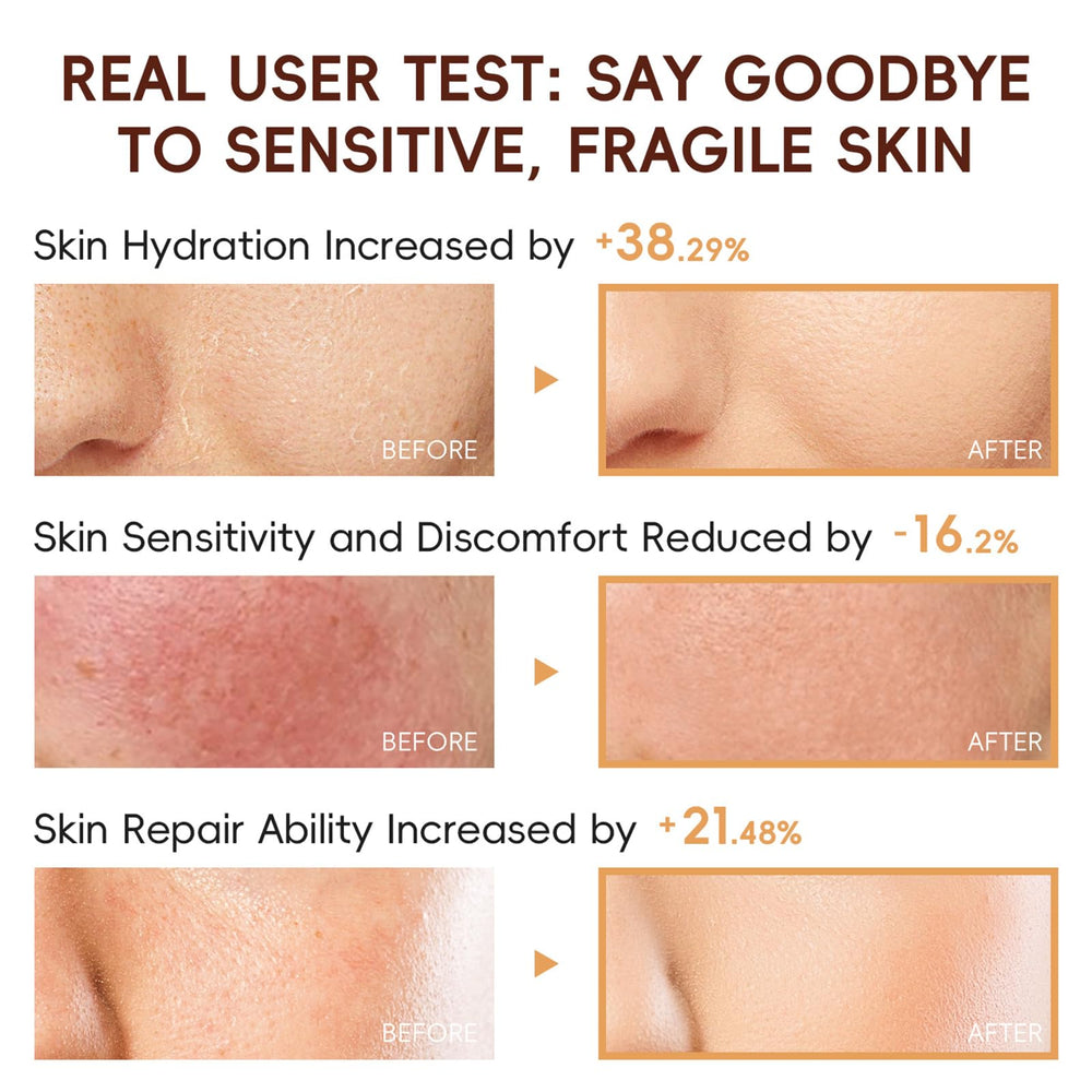 EONFAVE rice skincare set face-cream locks in moisture and softness