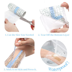 Eorbow clear second skin dressing on skin provides breathable shield.