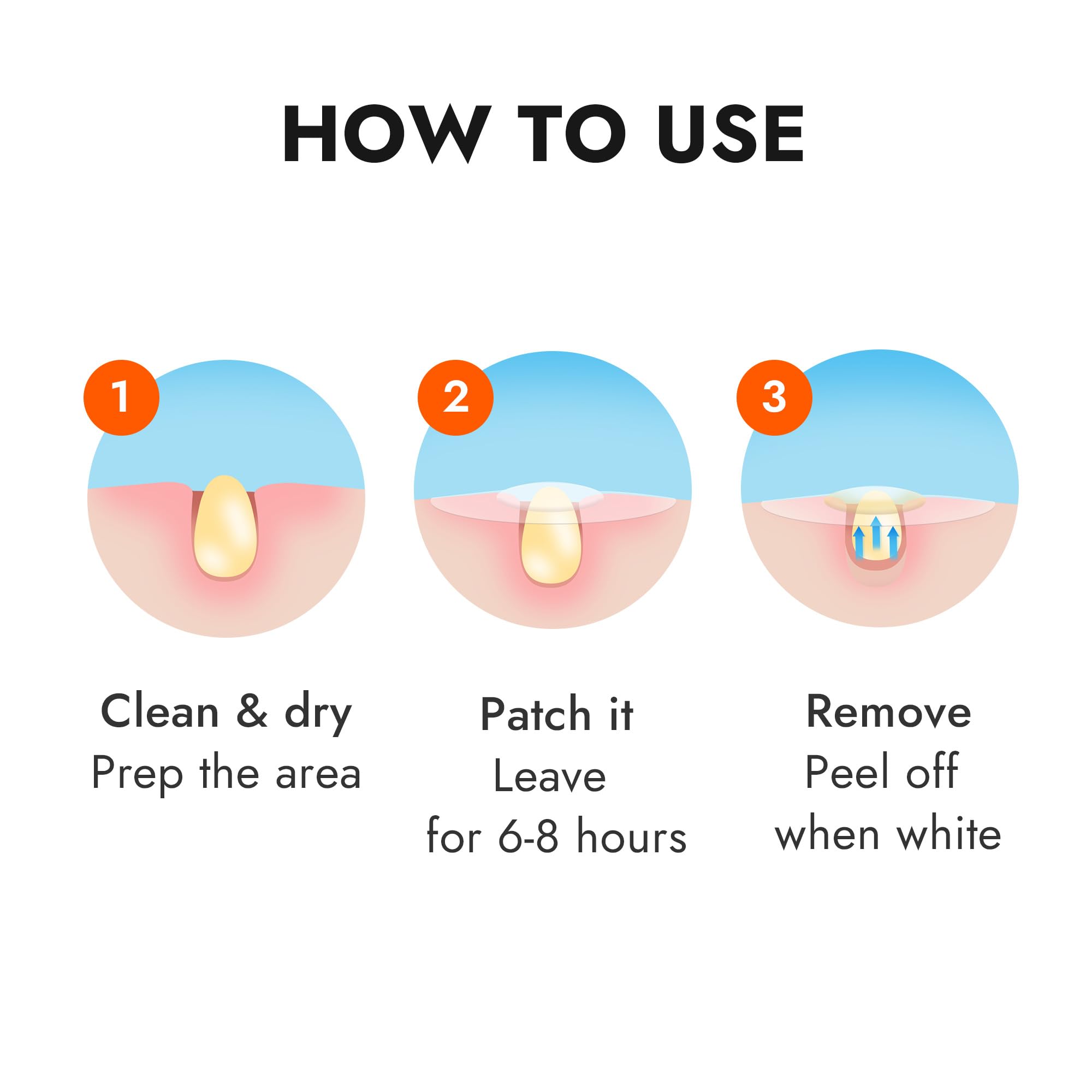 Epielle over-zit patches all-day wear image for daily activities.