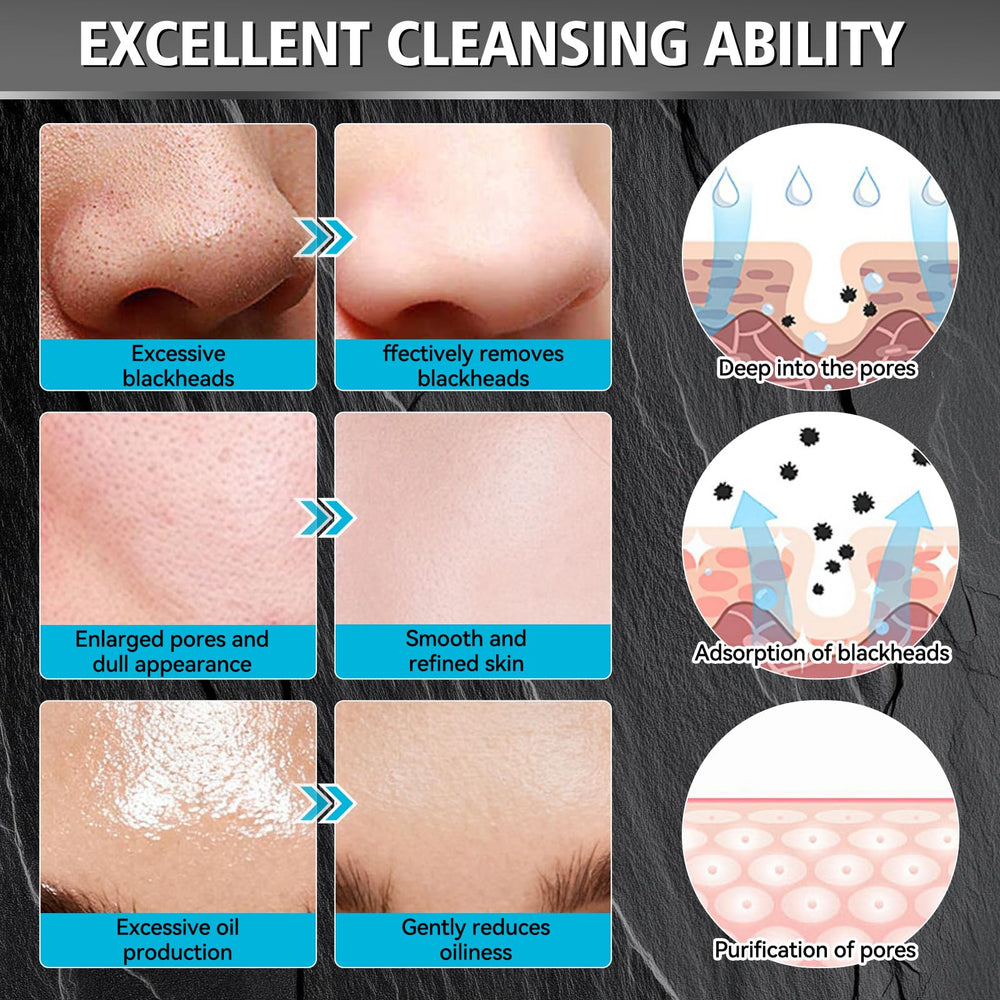 Erigathe Charcoal Peel Off Mask targets clogged pores for smoother skin.