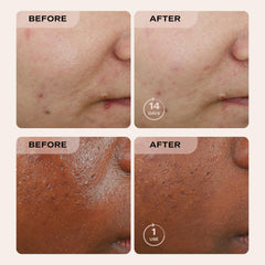Massaging Erno Laszlo Sea Mud bar onto a damp face.