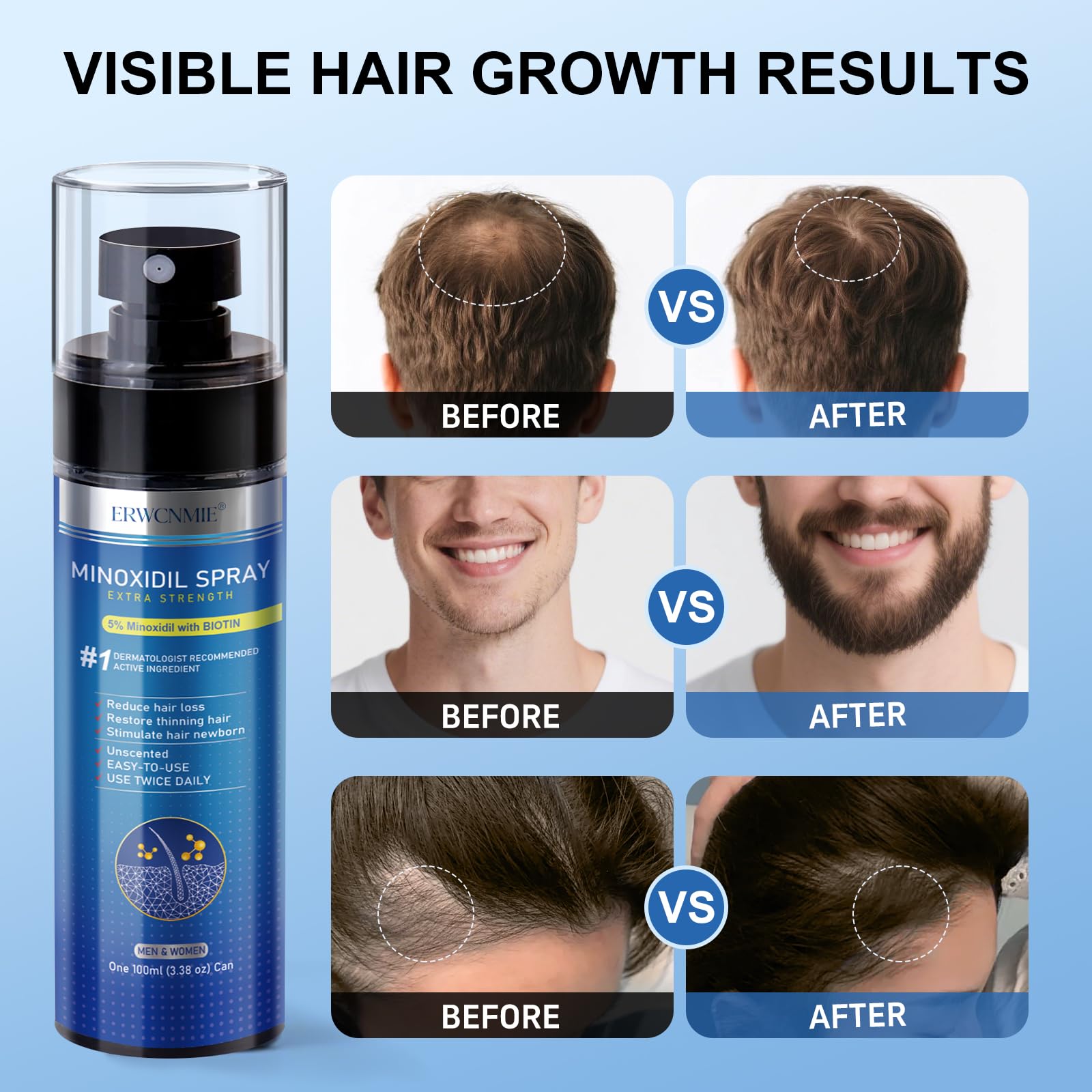 ERWCNMIE minoxidil bottle label highlighting key ingredients