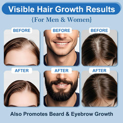 ERYLVEKA minoxidil foam ingredients include biotin for stronger strands