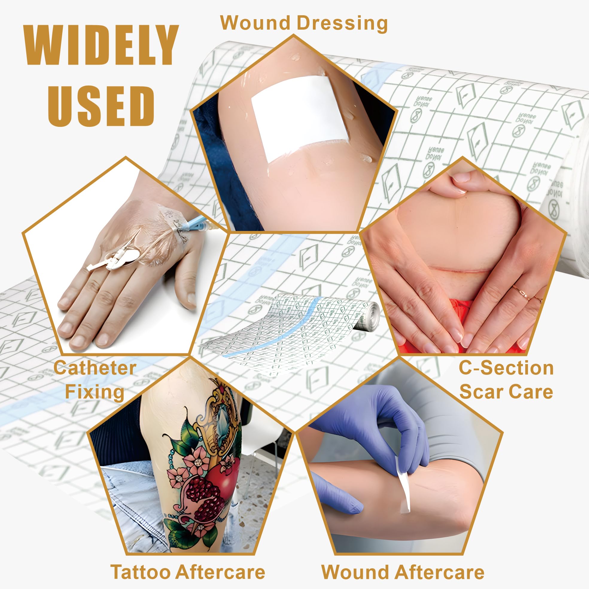 ES ETRSHIELD first-24-52-hours protection helps keep the environment clean during healing.
