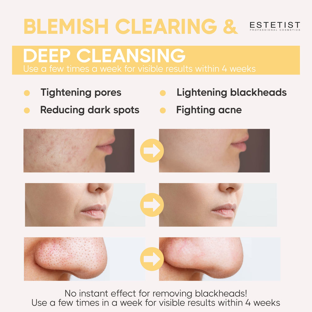 ESTETIST aloe vera and plant extracts soothe redness during exfoliation