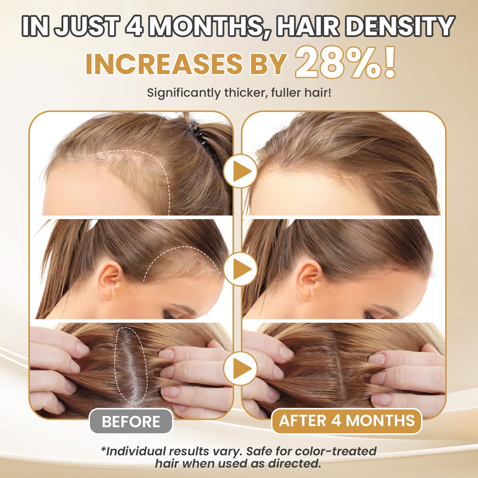 ETOVO women's minoxidil serum applying to scalp for improved hair appearance.