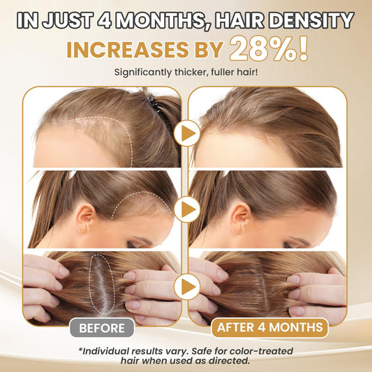 ETOVO women's minoxidil serum applying to scalp for improved hair appearance.