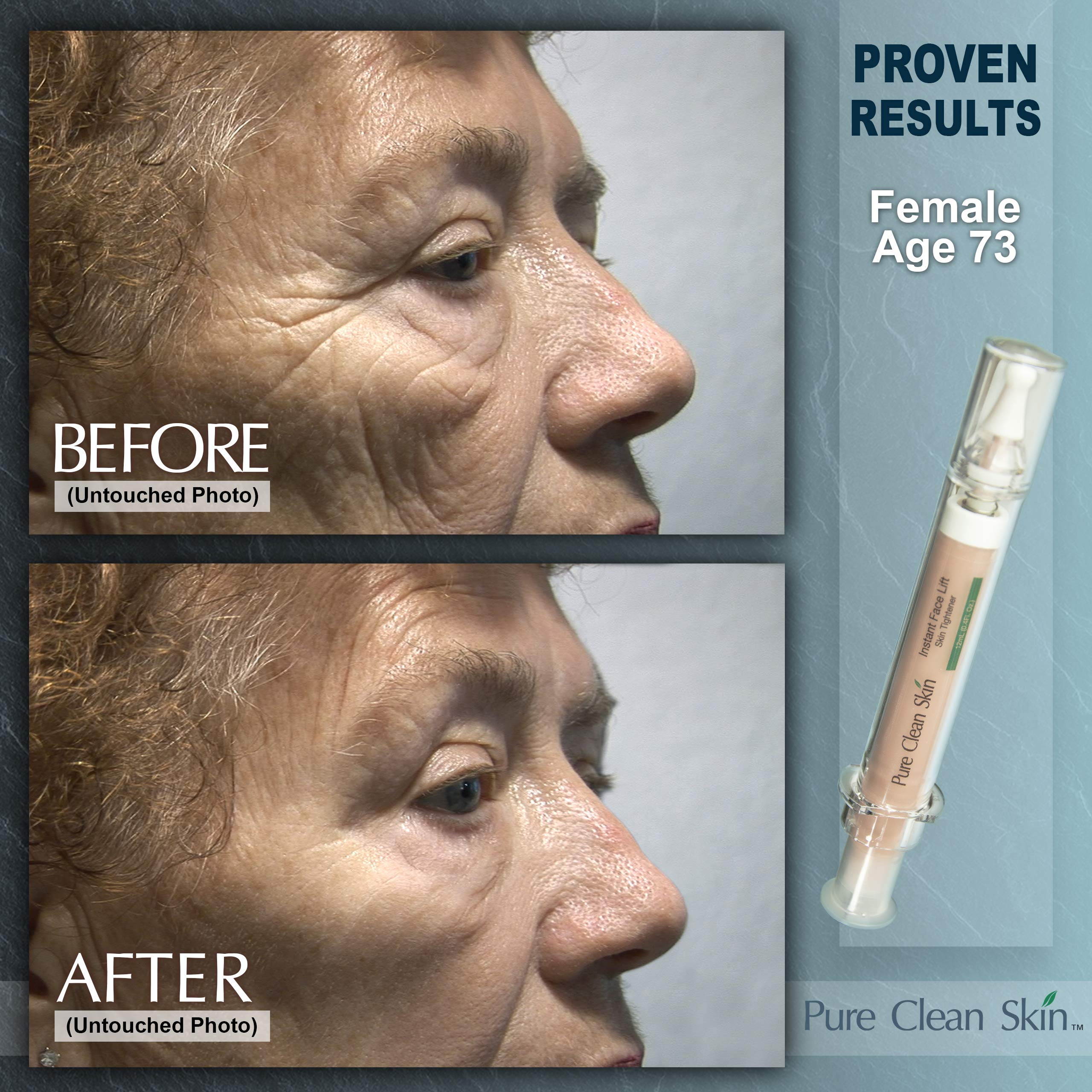 EUZEN Applying cream to cheeks for a refreshed look.