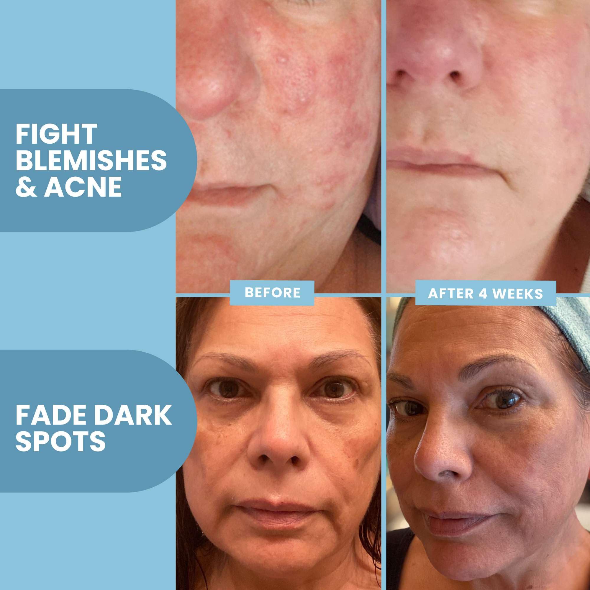 Ferulic acid focus in Eva Naturals Serum for antioxidant protection