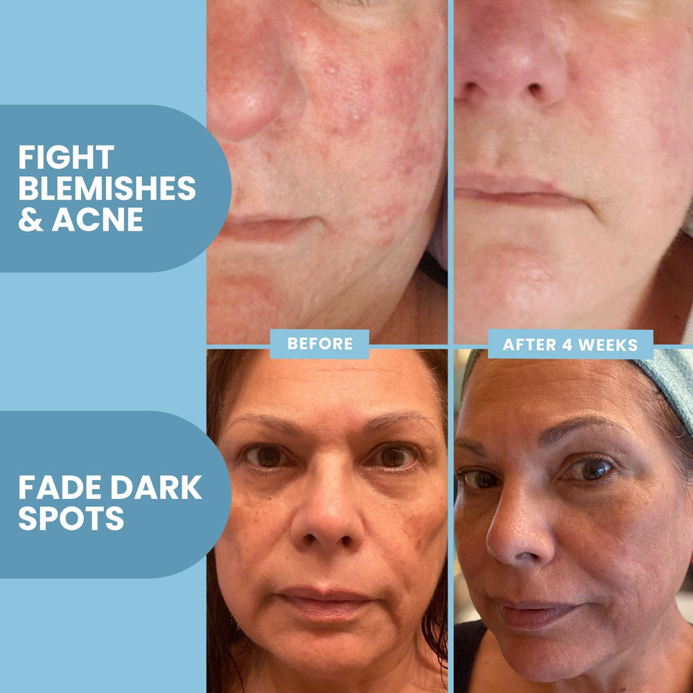 Ferulic acid focus in Eva Naturals Serum for antioxidant protection