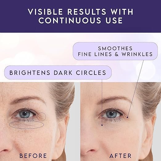 Evdayam hydrating under-eye balm delivers light, non-greasy moisture.