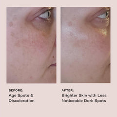 Close-up of EVER Vitamin C serum texture absorbed on skin.