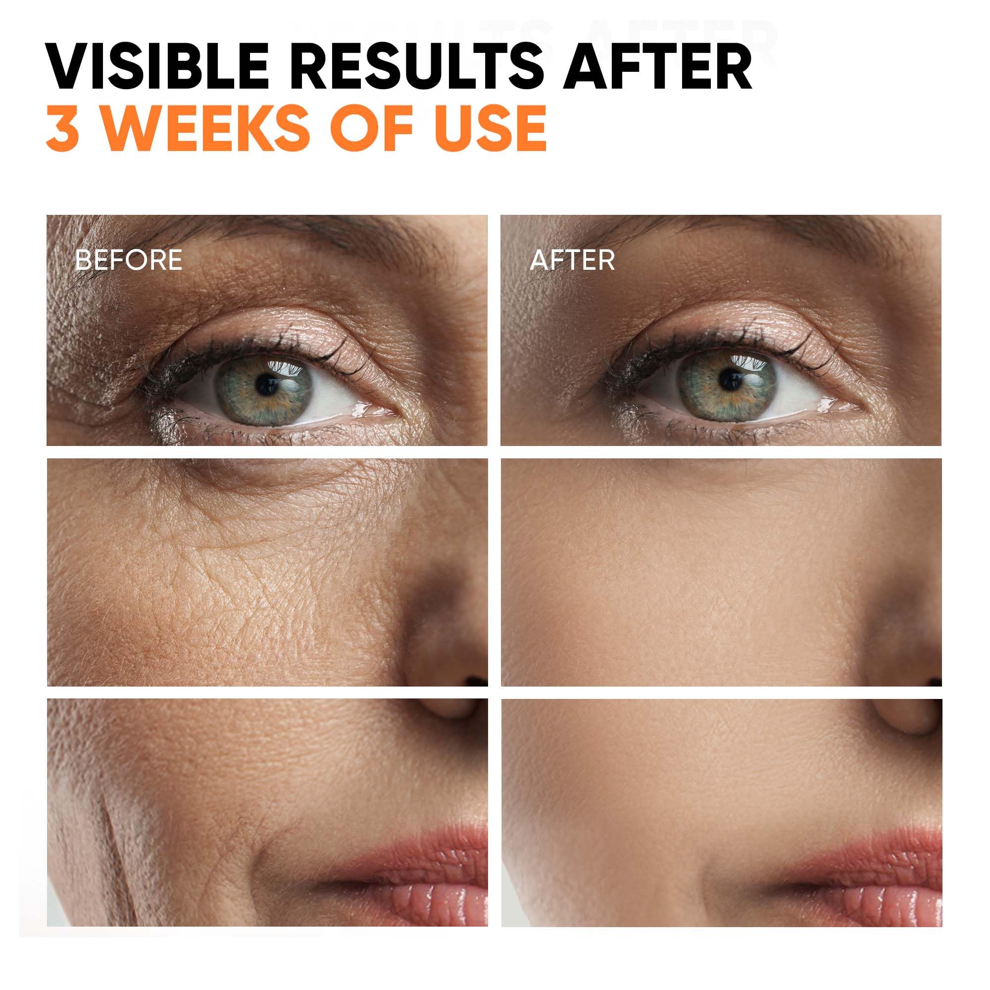 EVERYOUTH Glycolic exfoliation elevating texture and clarity for refined pores.