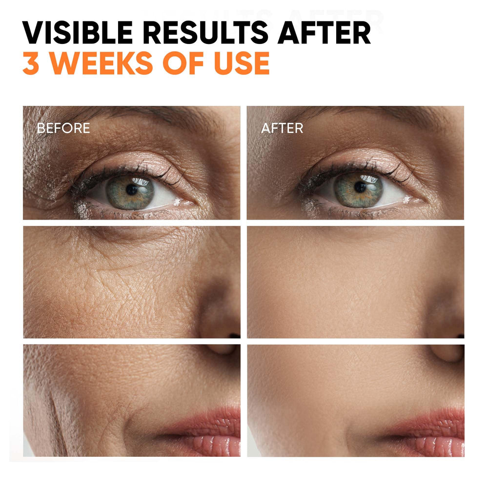 EVERYOUTH Glycolic exfoliation elevating texture and clarity for refined pores.