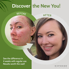 Exposed cleanser with sage extract and salicylic acid soothing irritated areas