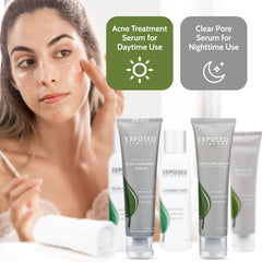 Exposed Skin Care acne kit application sequence step-by-step routine inspiration