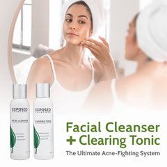 Exposed Skin Care acne kit lifestyle shot shows daily skincare integration