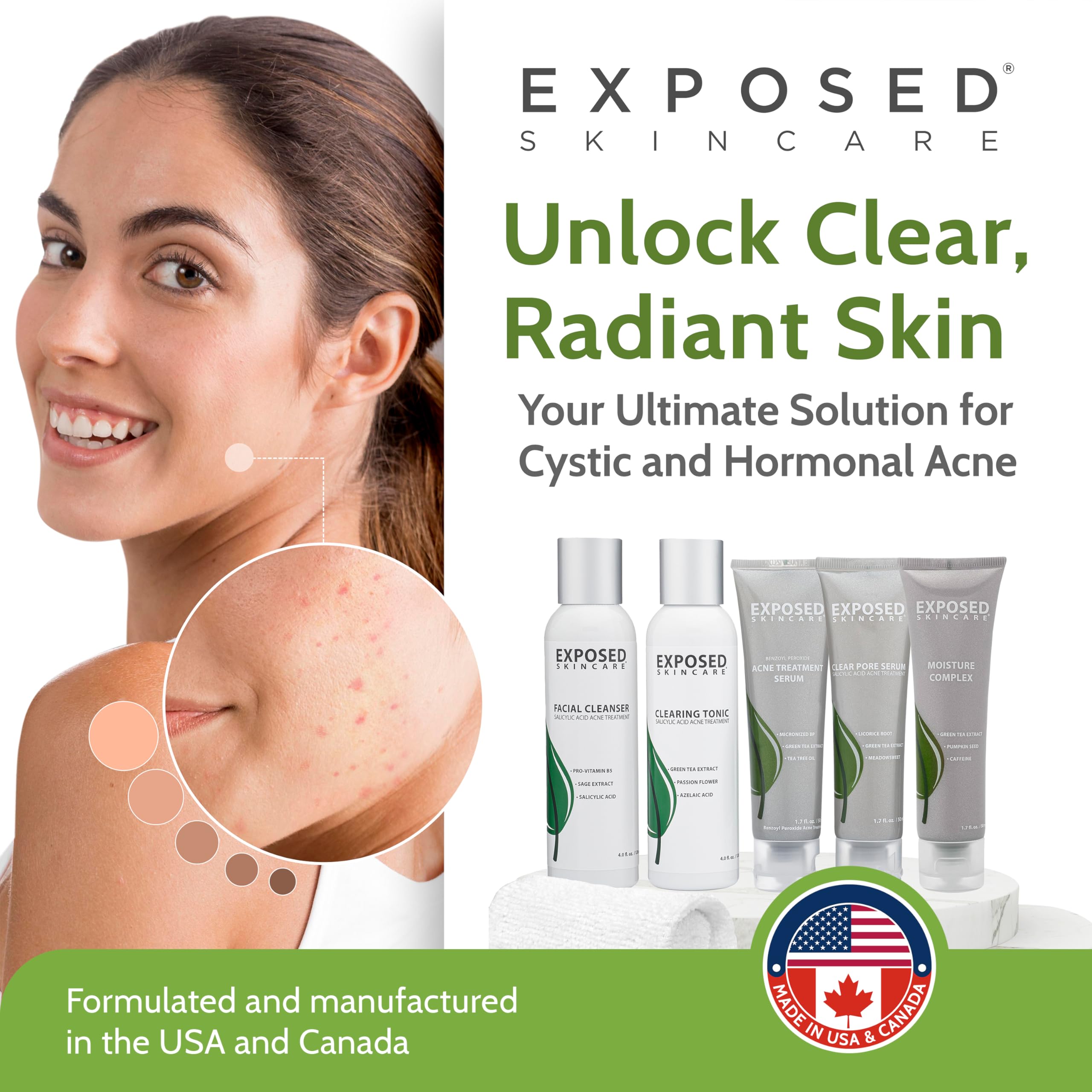 Exposed Skin Care moisturizer bottle locks in hydration without clogging pores