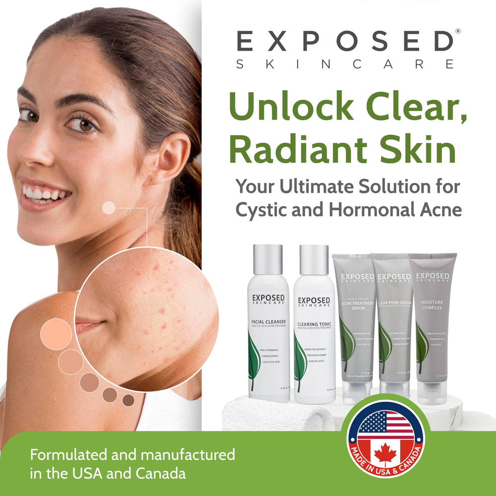 Exposed Skin Care moisturizer bottle locks in hydration without clogging pores