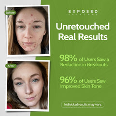 Exposed Skin Care clearing tonic preps skin and balances oil.