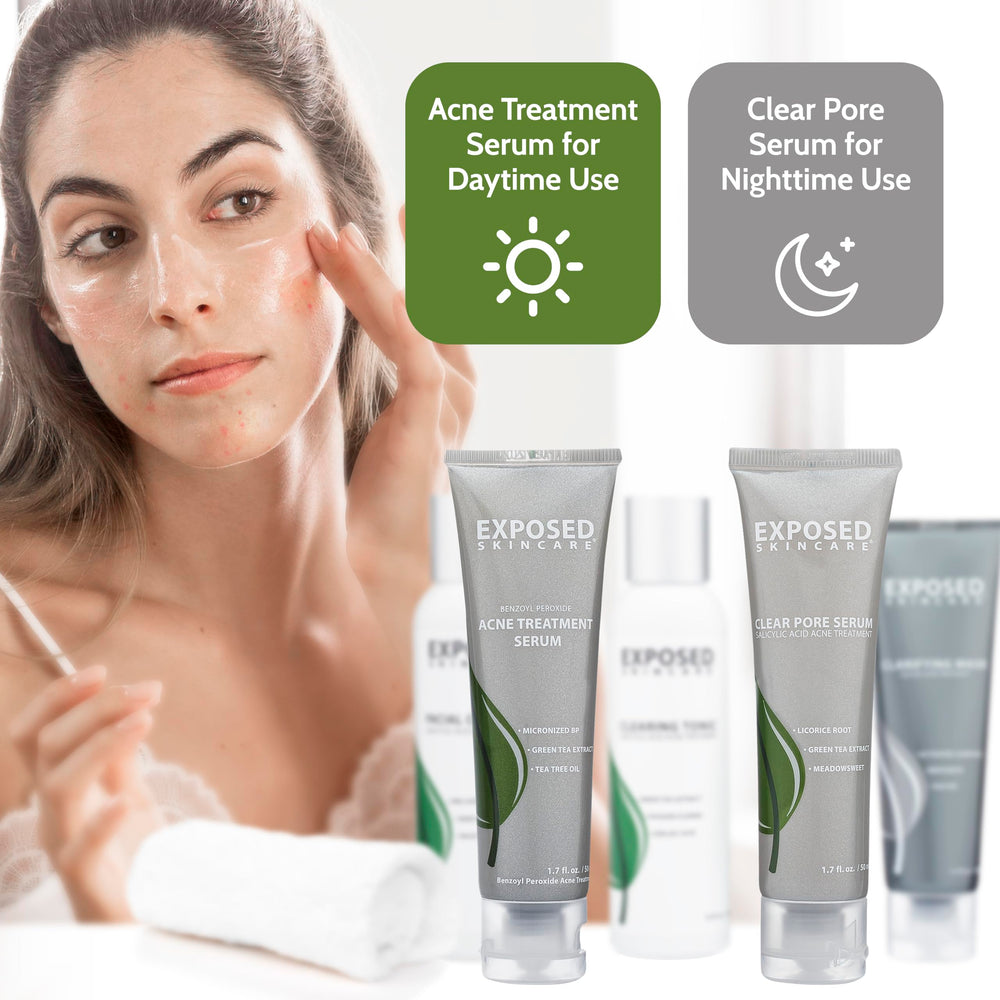 Exposed Skin Care cloth for gentle removal after treatment.