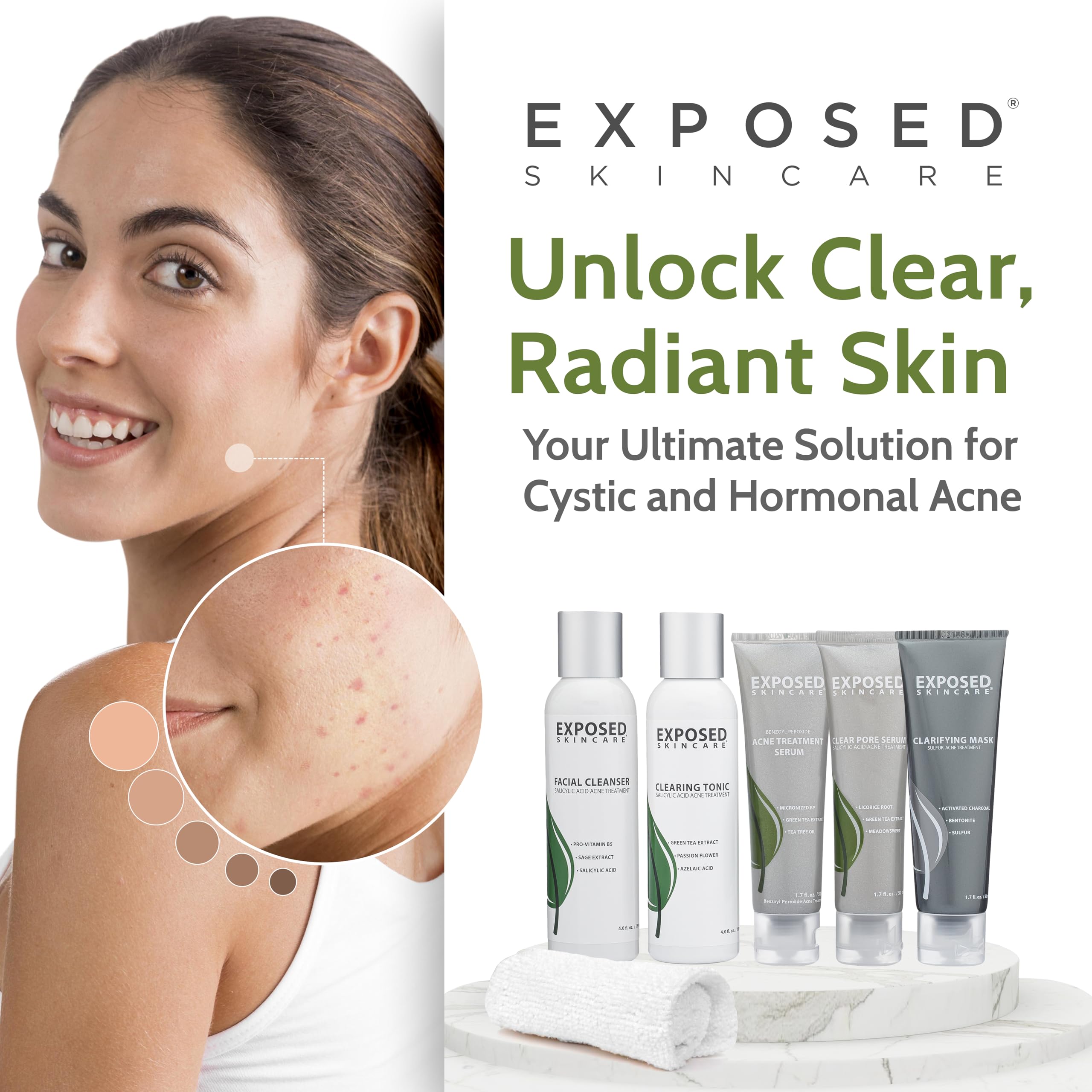 Exposed Skin Care ingredient bottles showcase key actives.
