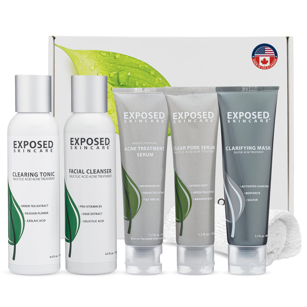 Exposed Skin Care kit box shows the complete acne system for daily use.