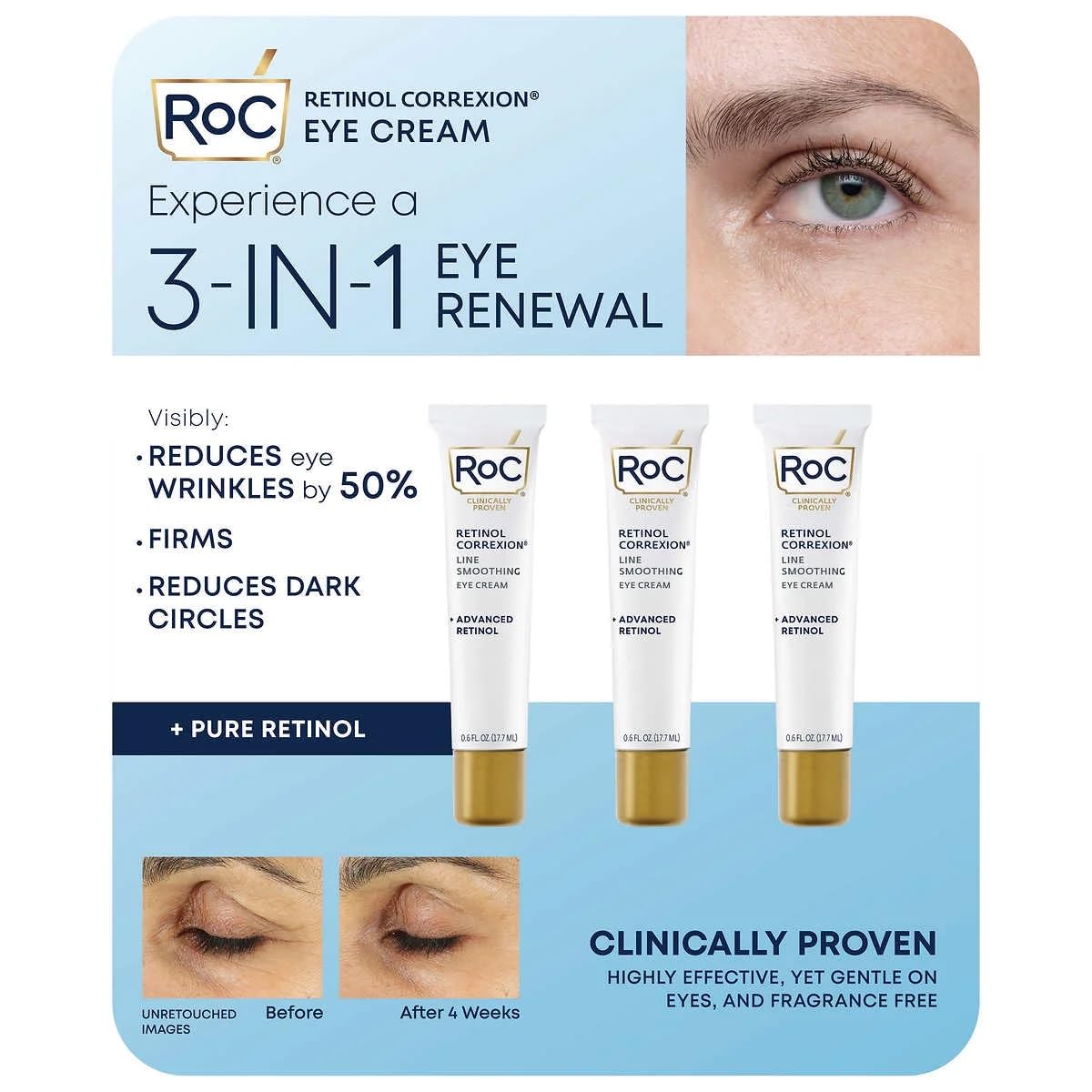 Eye See RoC Line Smoothing Eye Cream pack3 jar smooths lines and hydrates delicate eye skin.