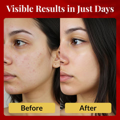 FACEDOCTOR Complexion Bar Soap with sea buckthorn oil, nourishing and antioxidant-rich.