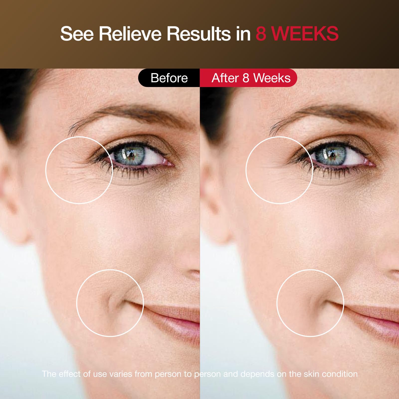 Facego cordless red light mask breathable nose design improves airflow during use.