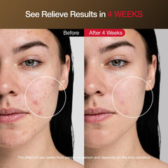 Facego cordless red light mask straps sit securely around the head for a stable fit.