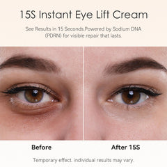 Fankr Sodium DNA renewal concept highlights smoother, more resilient-looking under-eye skin.