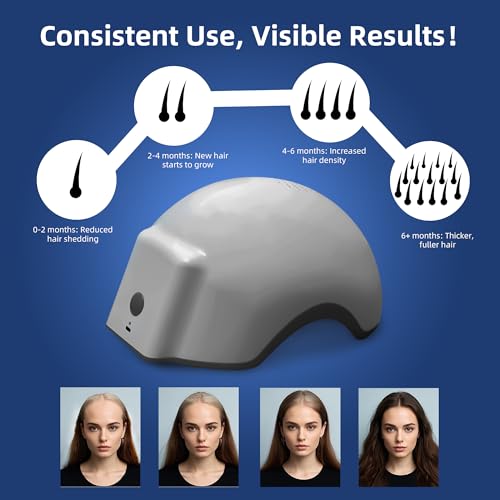 Hair Growth Device upper head coverage demonstrates broad treatment area