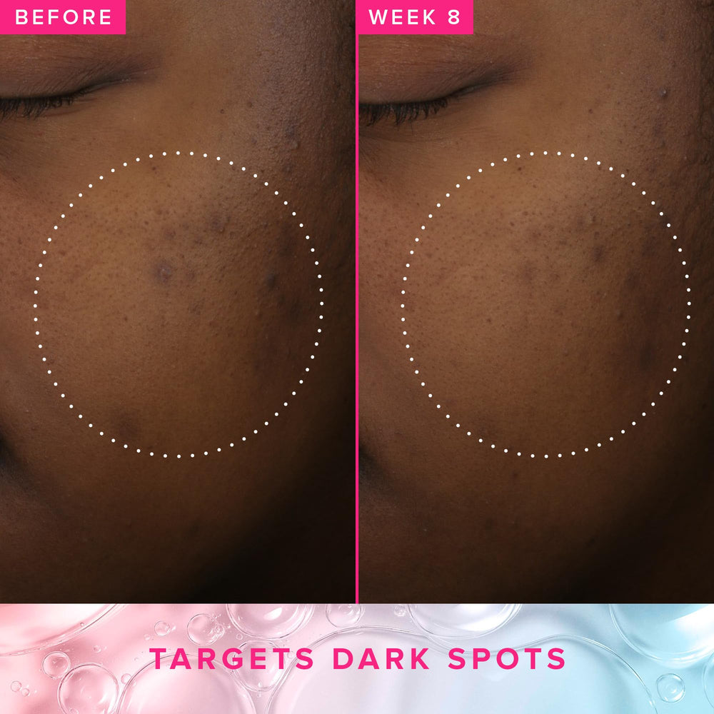 Farmacy toner application with cotton pad shows easy daily exfoliation