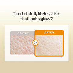 FARMSKIN Rice Fermented Filtrate and Niacinamide brighten and even tone.