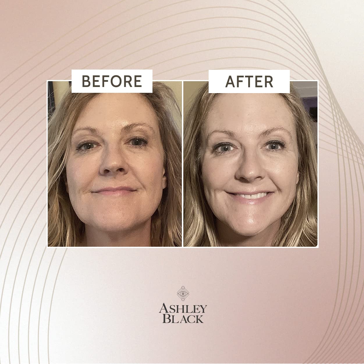 Ingredients spotlight highlights botanicals designed for long-term tightening.
