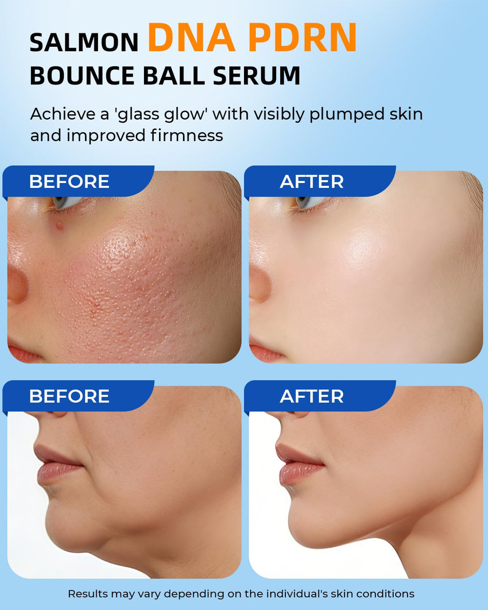Multi-hyaluronic acid formula delivering deep hydration