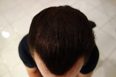 Finally Hair fibers applied to thinning crown for a fuller, natural look.