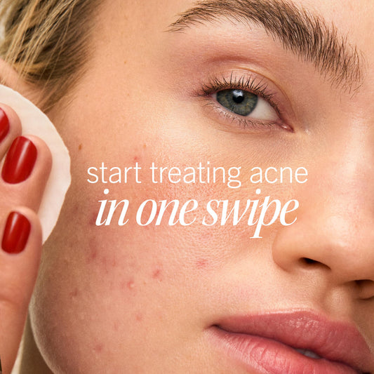 First Aid Beauty Acne Pads dual-sided pad used to treat acne-prone areas.