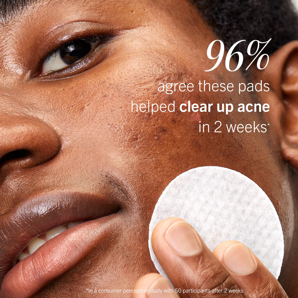 First Aid Beauty Acne Pads being used as part of a skincare routine.