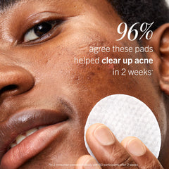 First Aid Beauty Acne Pads being used as part of a skincare routine.