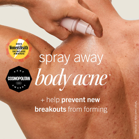 First Aid Beauty Body Acne Spray uses 2% salicylic acid to target body blemishes.