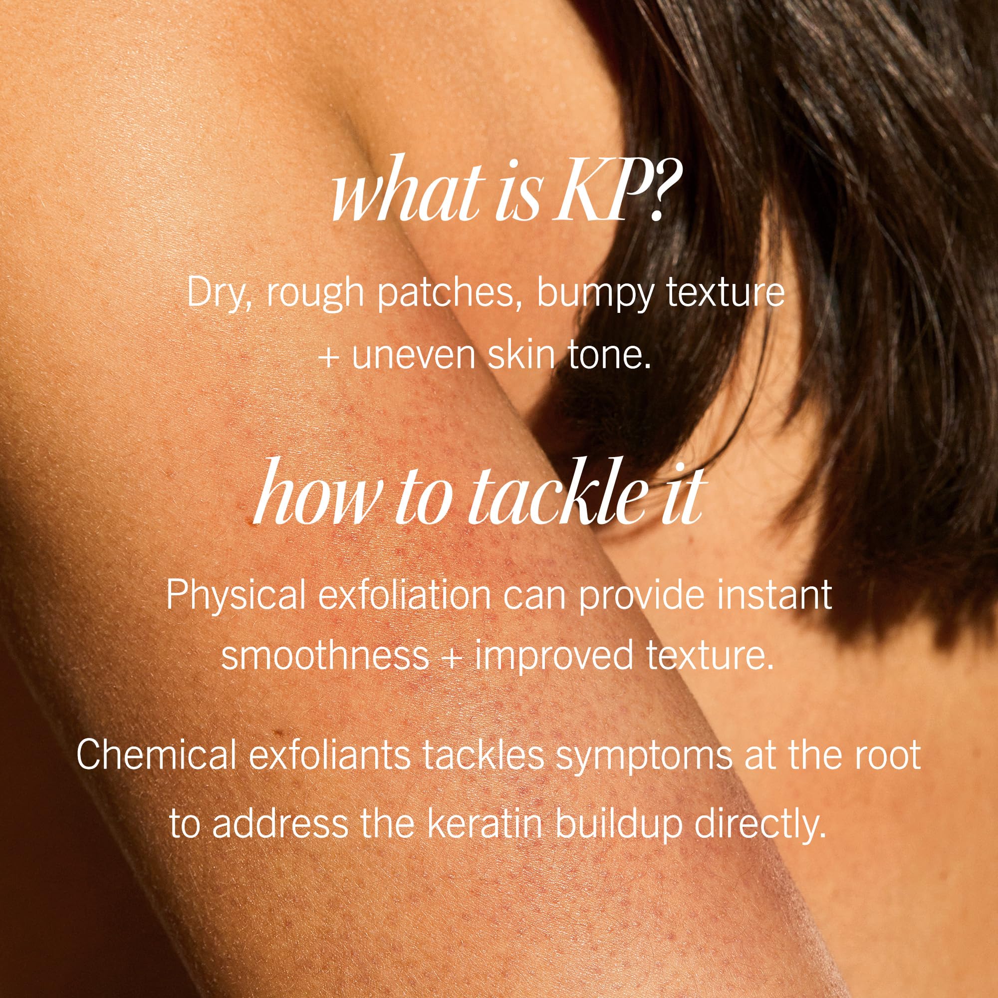 First Aid Beauty KP Bump Eraser pumice beads macro demonstrates non-plastic exfoliation