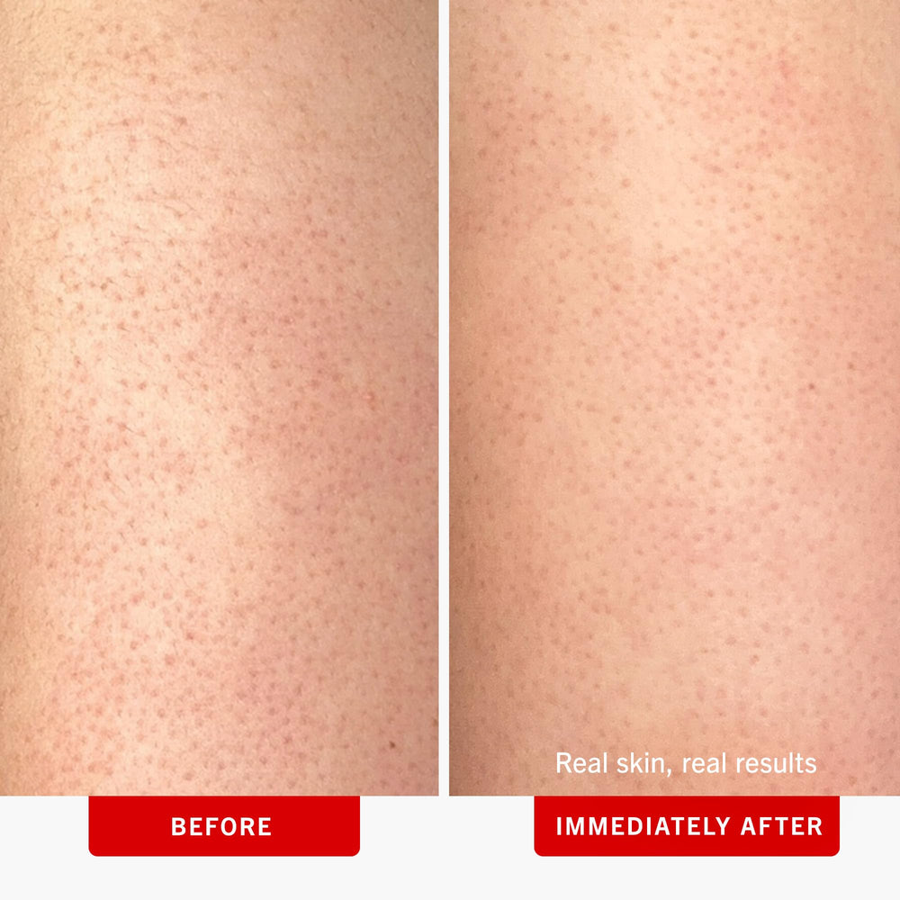 First Aid Beauty KP Bump Eraser texture close-up showing buffing beads